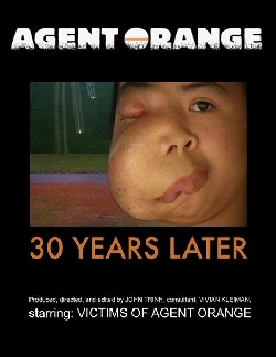 Agent Orange: 30 Years Later