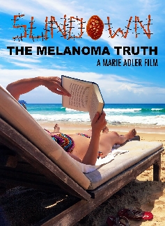 Sundown: The Melanoma Truth